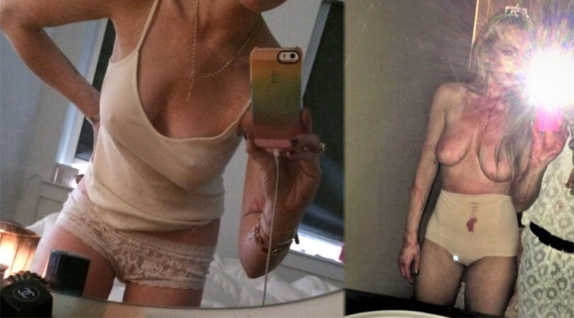 Lindsay Lohan – Sexy Big Boobs in Hot Topless Leaked Pictures (NSFW)